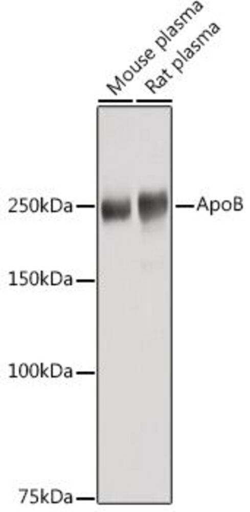 Anti-Apolipoprotein B Antibody, 100 µl - Luminix Health