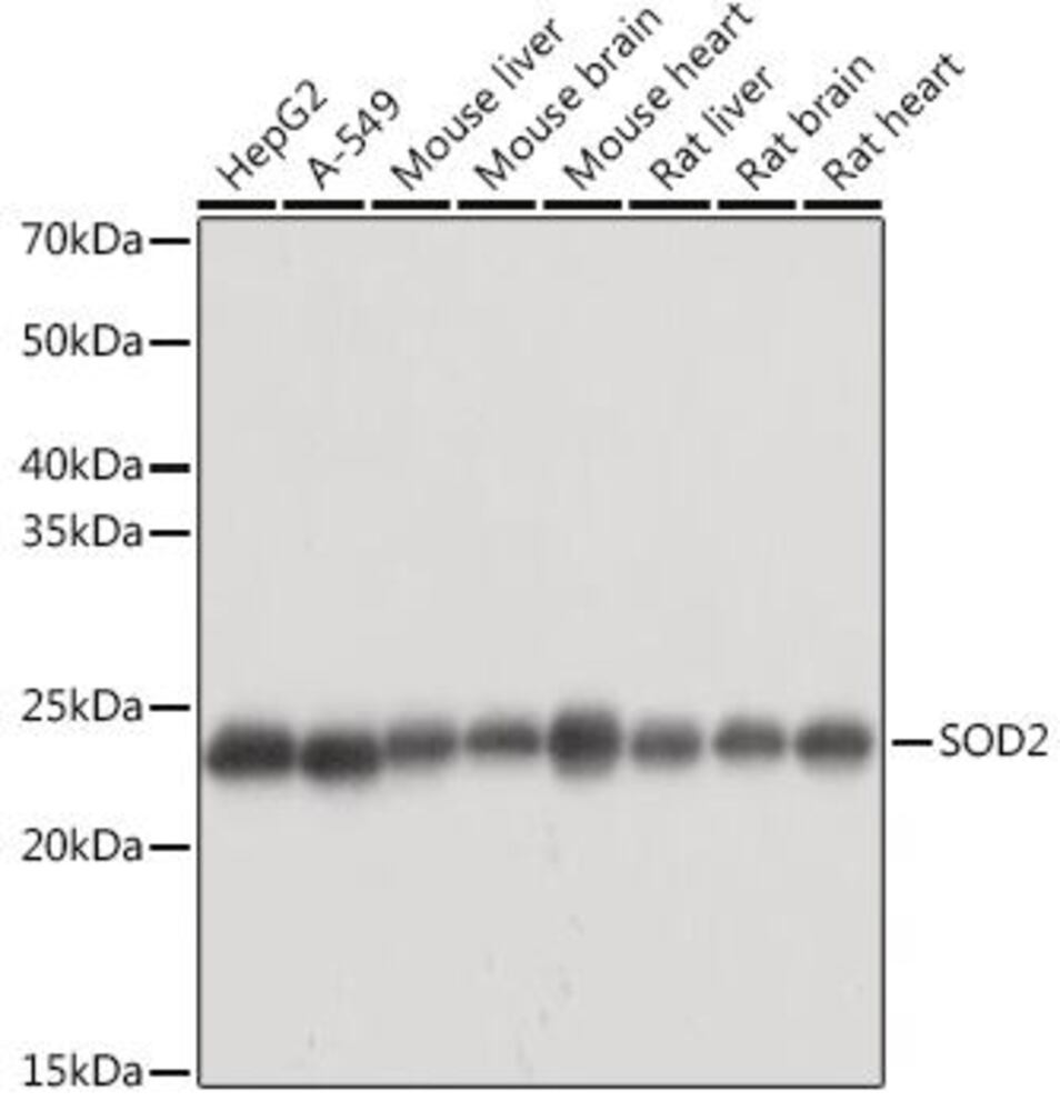 Anti-SOD2 / MnSOD Antibody, 100 µl - Luminix Health