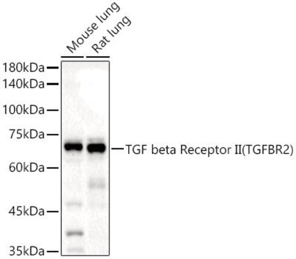 Anti-TGF beta Receptor II Antibody, Density (D) 1 g/cm³, Storage temp. +4 °C - Luminix Health