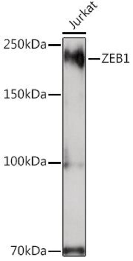 Anti-ZEB1 Antibody, 100 µl - Luminix Health