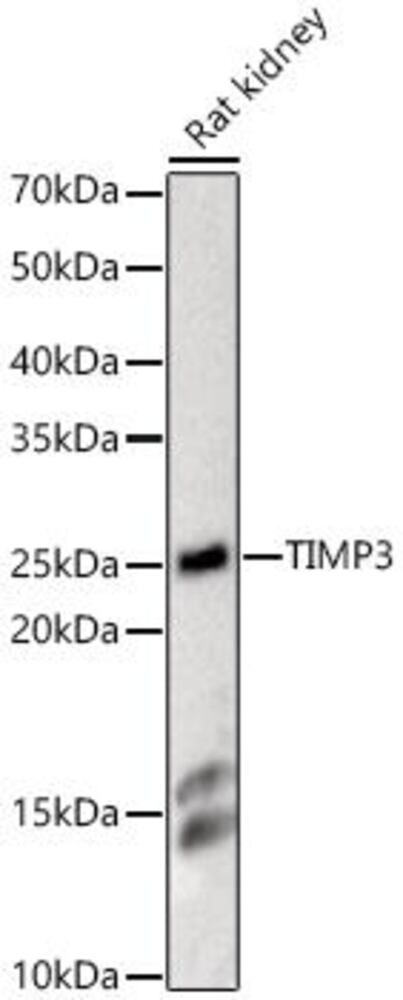 Anti-TIMP3 Antibody, 100 µl - Luminix Health