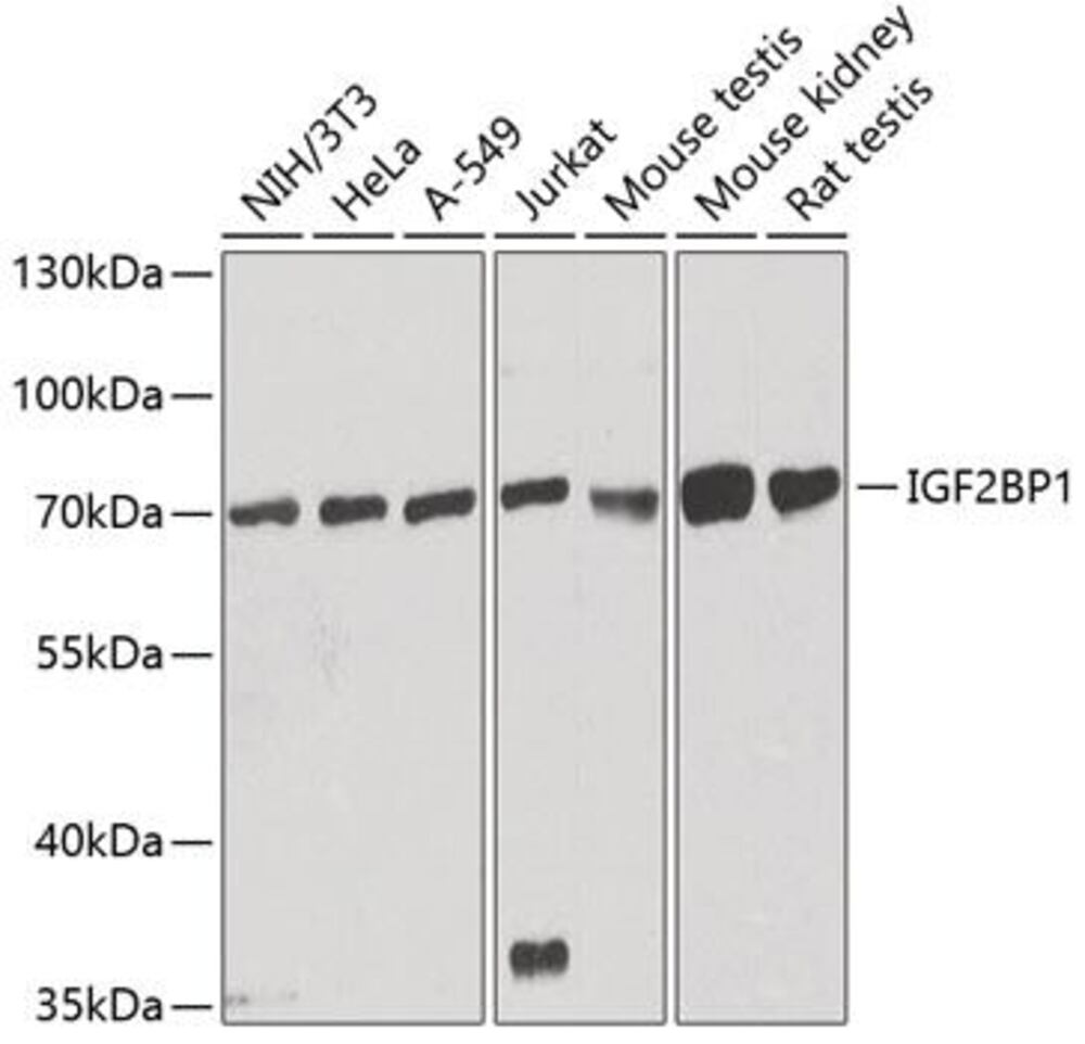 Anti-IGF2BP1 / IMP1 Antibody, 100 µl - Luminix Health