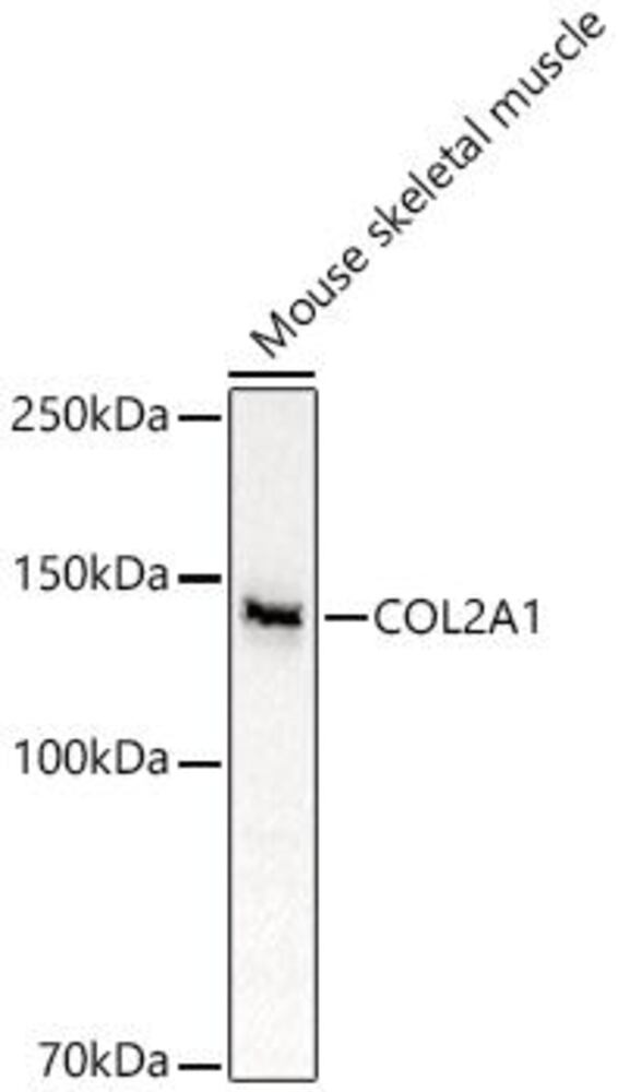 Anti-Collagen II Antibody, 100 µl - Luminix Health