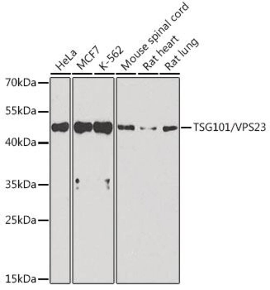 Anti-TSG101 Antibody, 100 µl - Luminix Health