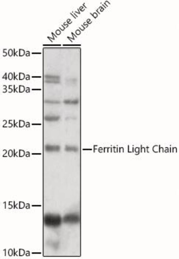 Anti-Ferritin Light Chain Antibody, 100 µl - Luminix Health