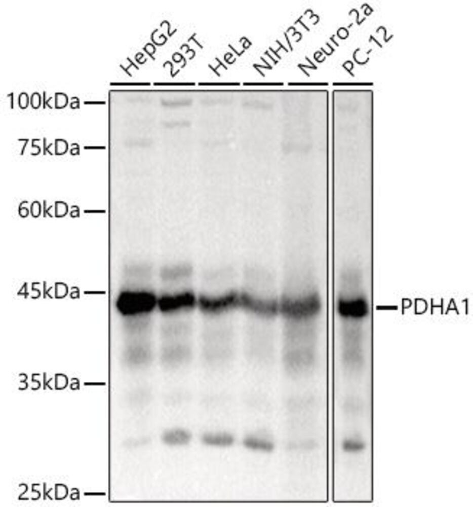 Anti-PDHA1 Antibody ab180759), 100 µl - Luminix Health
