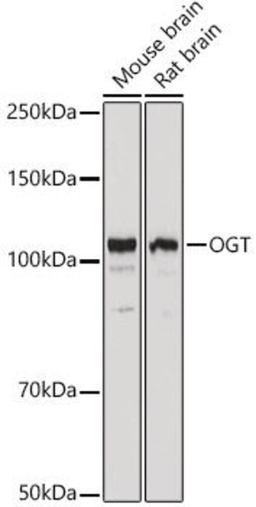 Anti-OGT Antibody ab185813), 100 µl - Luminix Health