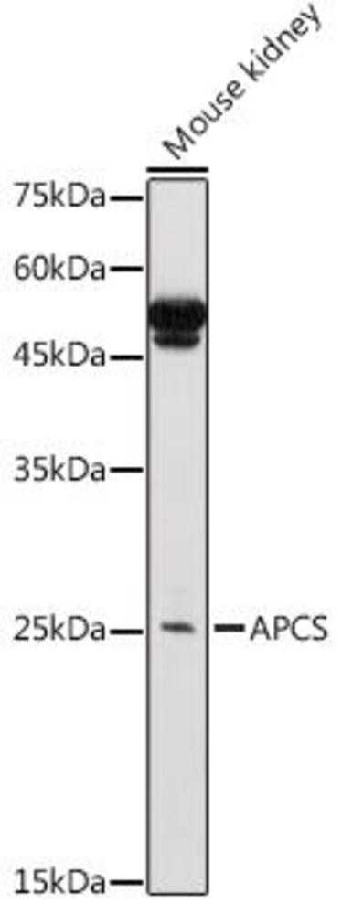 Anti-Serum Amyloid P / SAP Antibody, 100 µl - Luminix Health