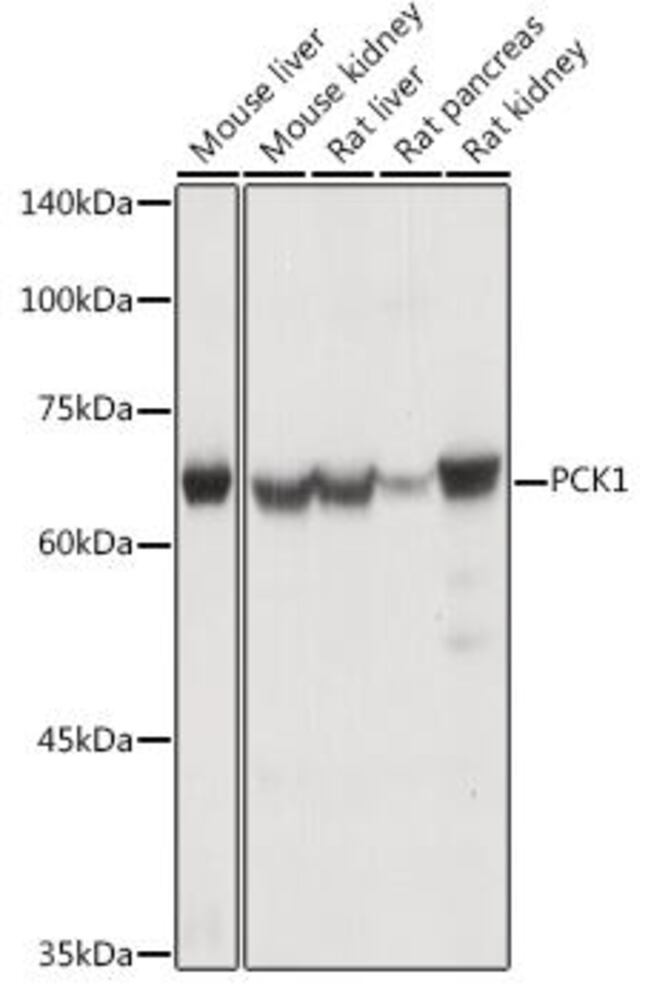 Anti-PCK1 / PEPC Antibody, 100 µl - Luminix Health