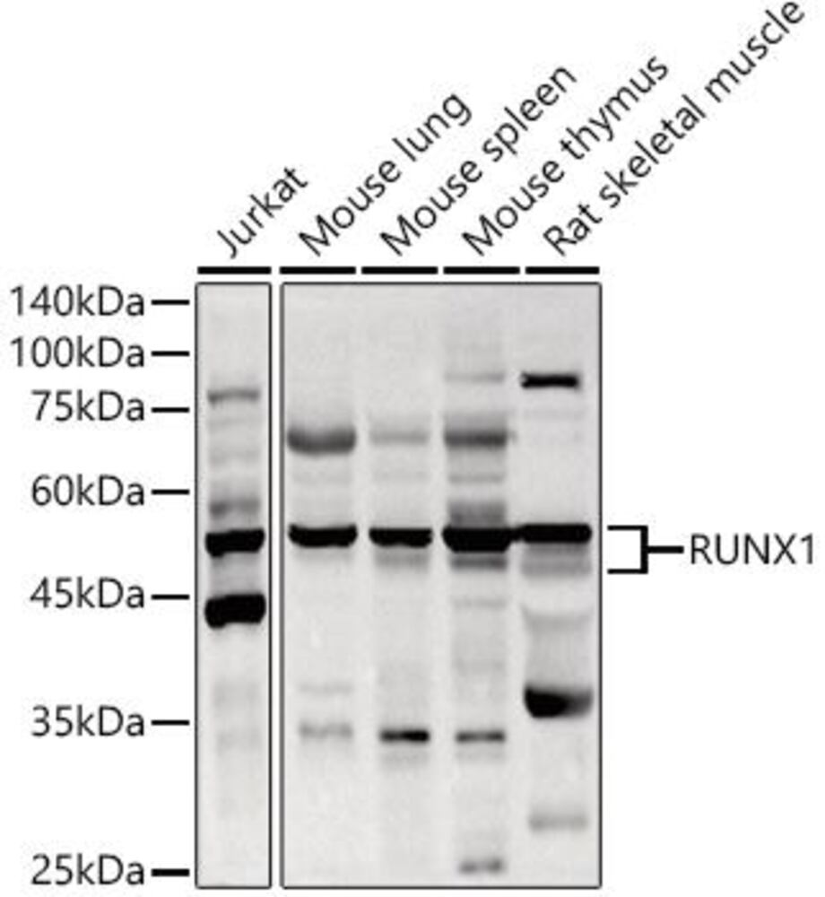 Anti-RUNX1 / AML1 Antibody, 100 µl - Luminix Health