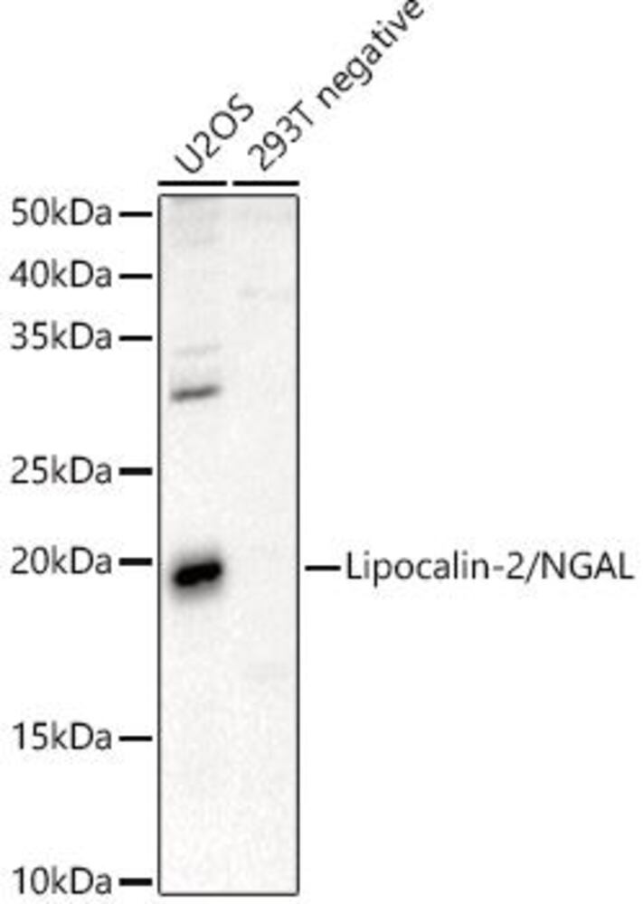 Anti-Lipocalin-2 / NGAL Antibody, 100 µl - Luminix Health