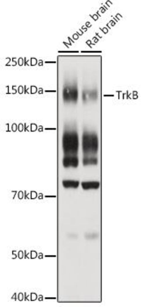 Anti-TrkB Antibody, 100 µl - Luminix Health