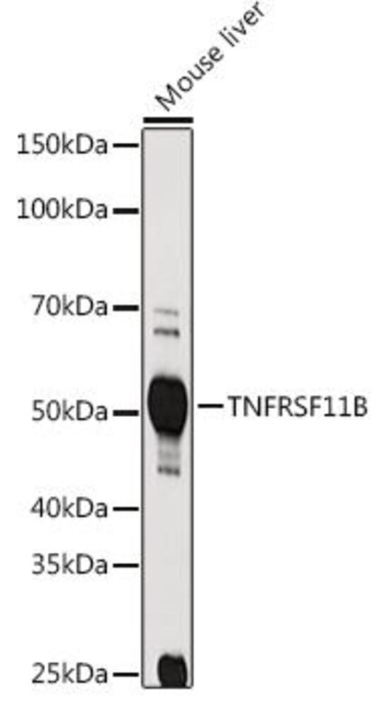 Anti-Osteoprotegerin Antibody, 100 µl - Luminix Health