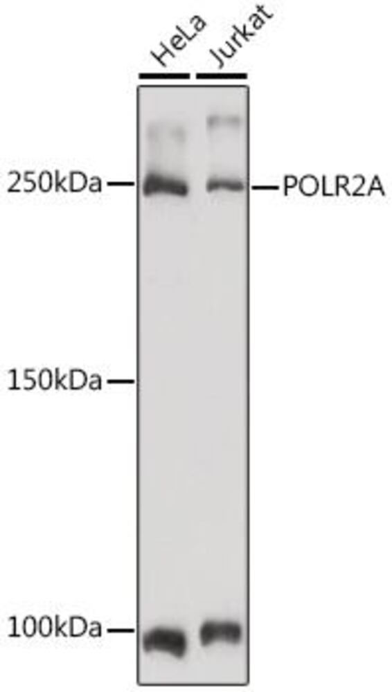 Image of A-RNA polym II CTD repeat YSPTSPS Antib