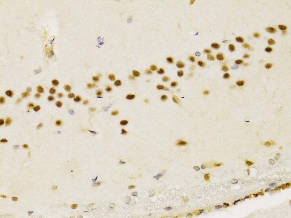 Anti-PTEN Antibody, Density (D) 1 g/cm³, Storage temp. +4 °C - Luminix Health