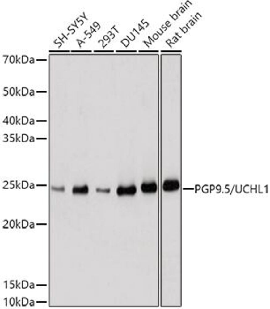 Anti-PGP9.5 Antibody, 100 µl - Luminix Health