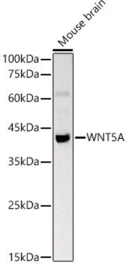 Anti-Wnt5a Antibody, 100 µl - Luminix Health
