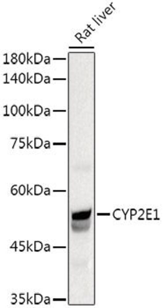 Anti-Cytochrome P450 2E1 Antibody, 100 µl - Luminix Health