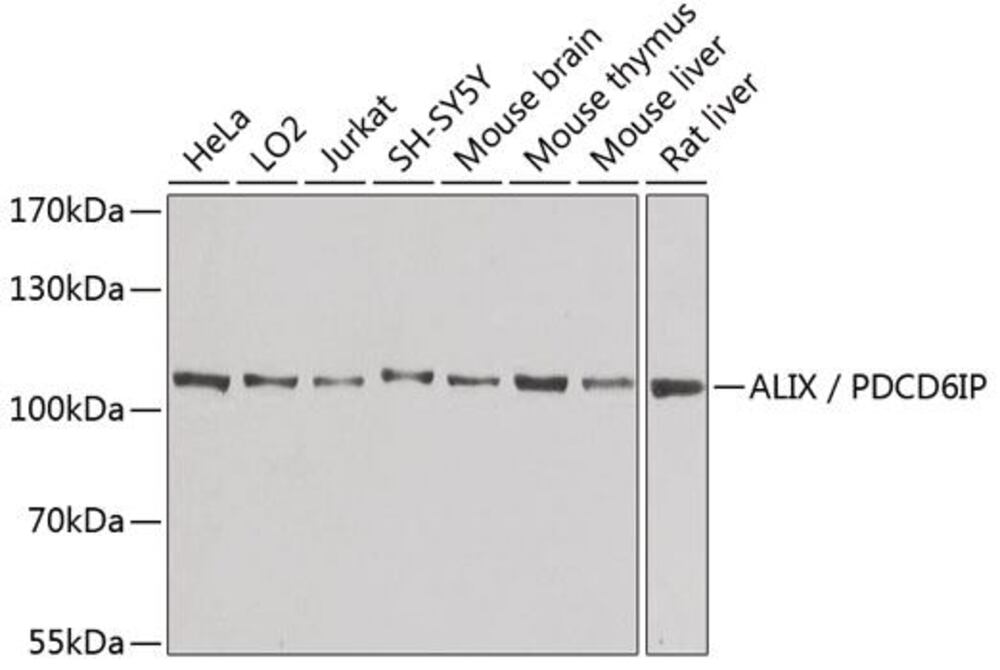 Anti-ALIX Antibody, 100 µl - Luminix Health