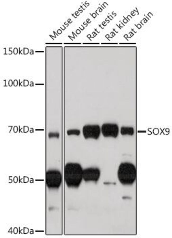 Anti-SOX9 Antibody, 100 µl - Luminix Health