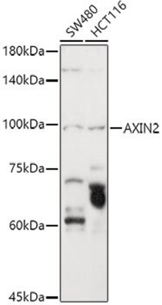 Anti-Axin 2 Antibody ab185821), 100 µl - Luminix Health