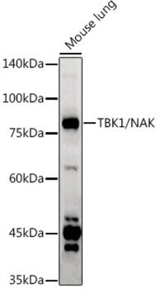 Anti-NAK / TBK1 Antibody, 100 µl - Luminix Health