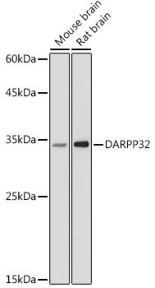 Anti-DARPP32 Antibody, 100 µl - Luminix Health