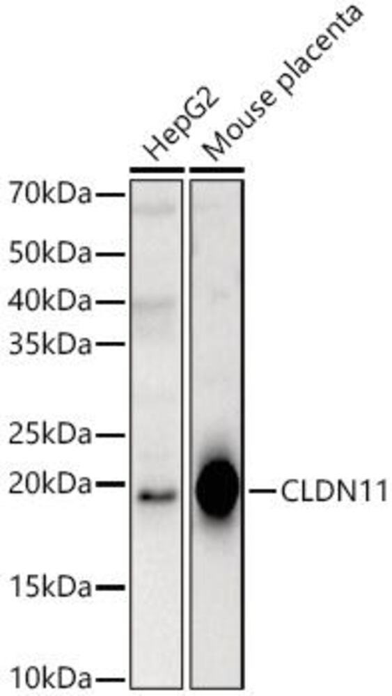 Anti-Oligodendrocyte Specific Prot Antib, 100 µl - Luminix Health