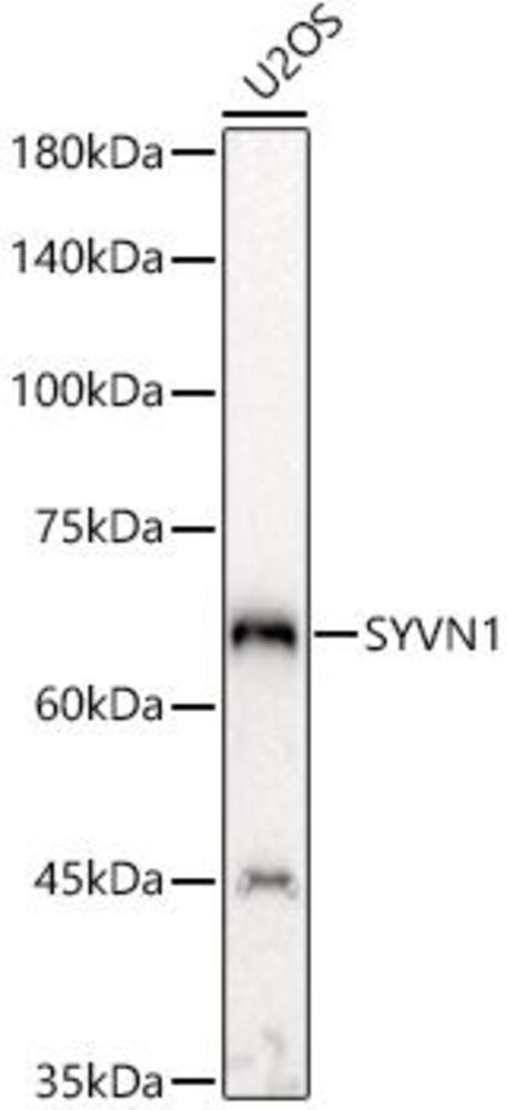 Anti-SYVN1 / HRD1 Antibody, 100 µl - Luminix Health