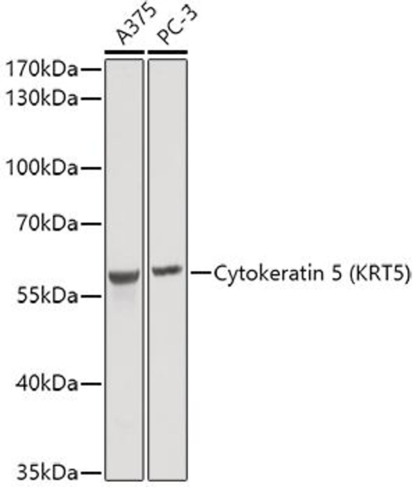 Anti-Cytokeratin 5 Antibody, 100 µl - Luminix Health