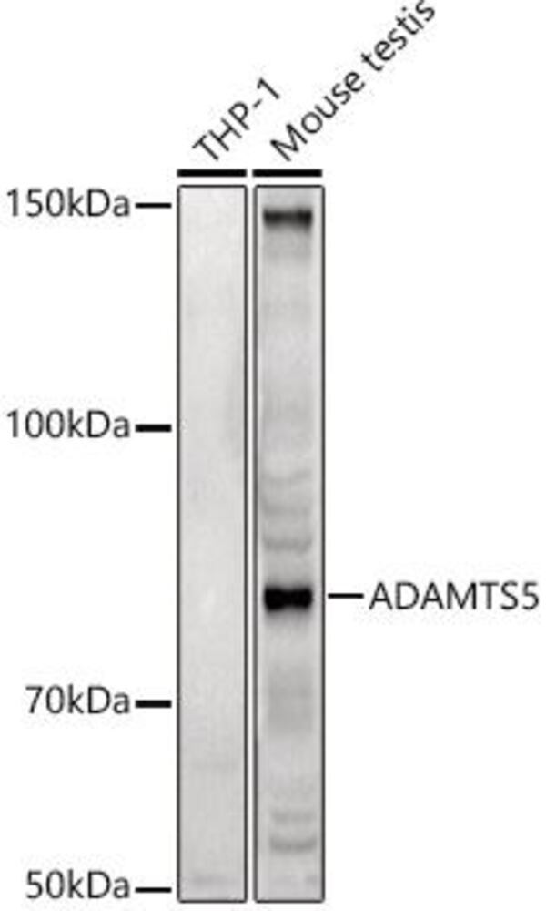 Anti-ADAMTS5 Antibody, 100 µl - Luminix Health