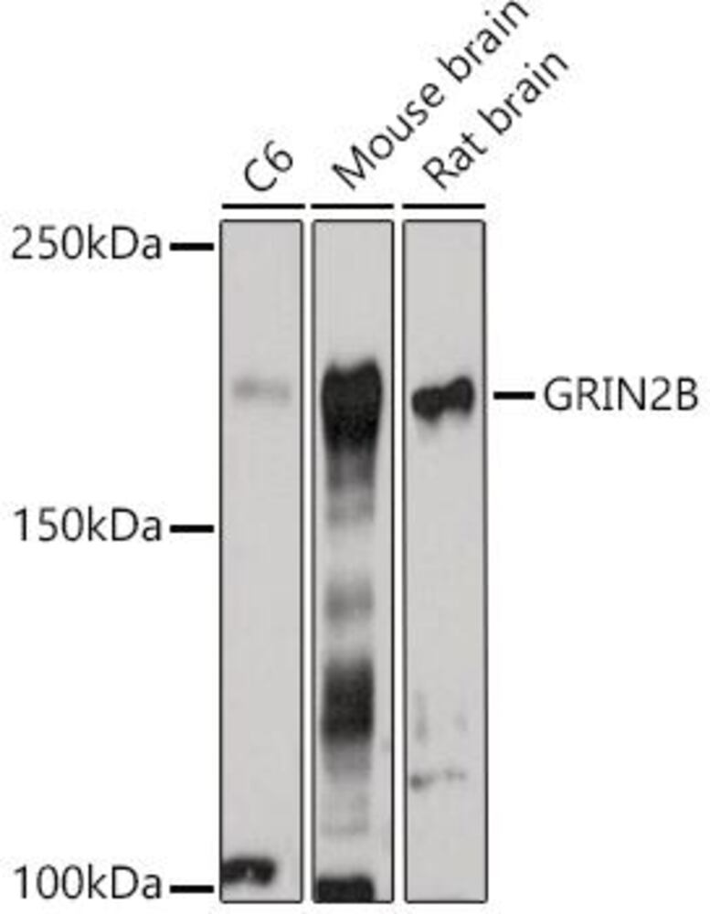 Anti-NMDAR2B Antibody, 100 µl - Luminix Health