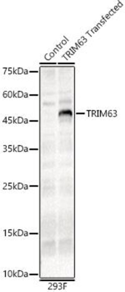 Anti-MURF1 Antibody, 100 µl - Luminix Health