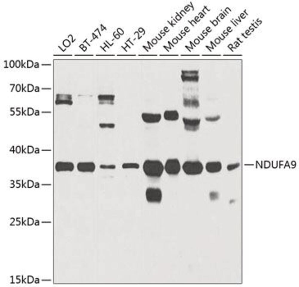 Anti-NDUFA9 Antibody, 100 µl - Luminix Health