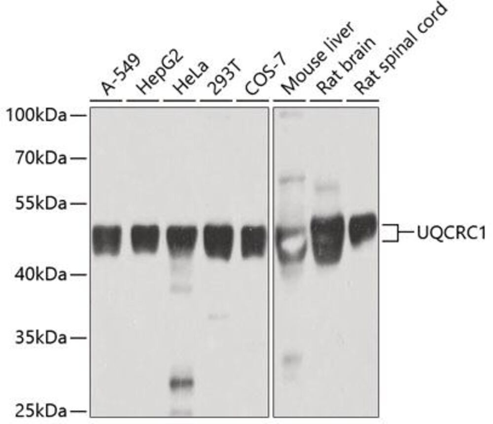 Image of A-Ubiquinol-Cytoch C RedCore ProtI Antib