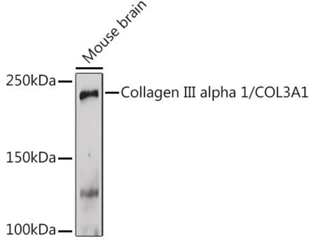 Anti-Collagen III Antibody, 100 µl - Luminix Health