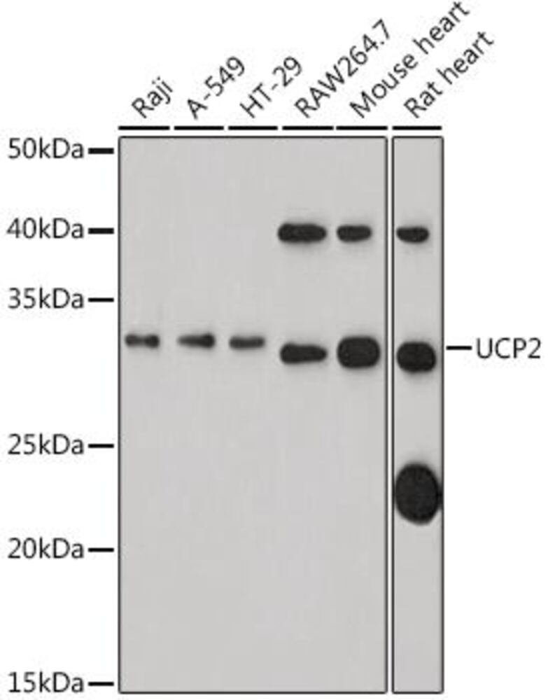 Anti-UCP2 Antibody, 100 µl - Luminix Health