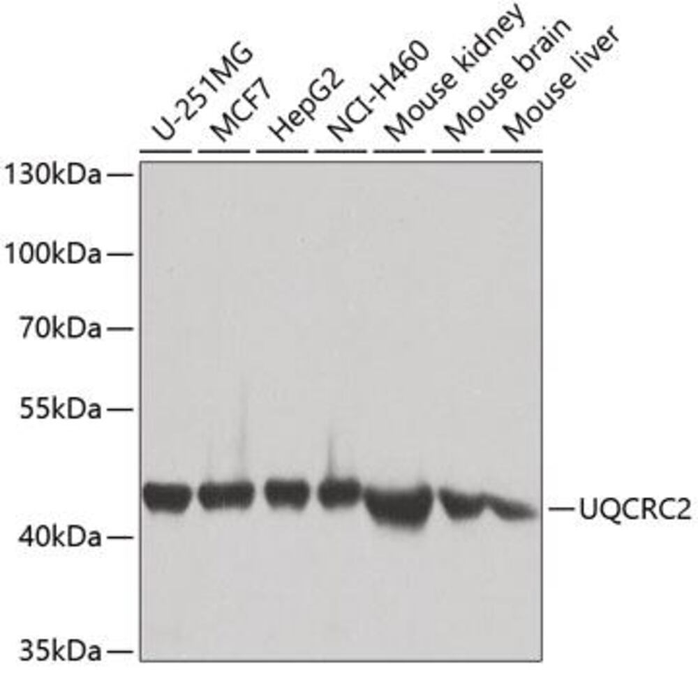 Anti-UQCRC2 Antibody, 100 µl - Luminix Health