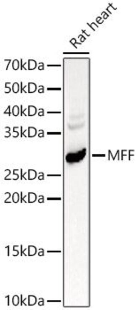 Anti-MFF Antibody, 100 µl - Luminix Health