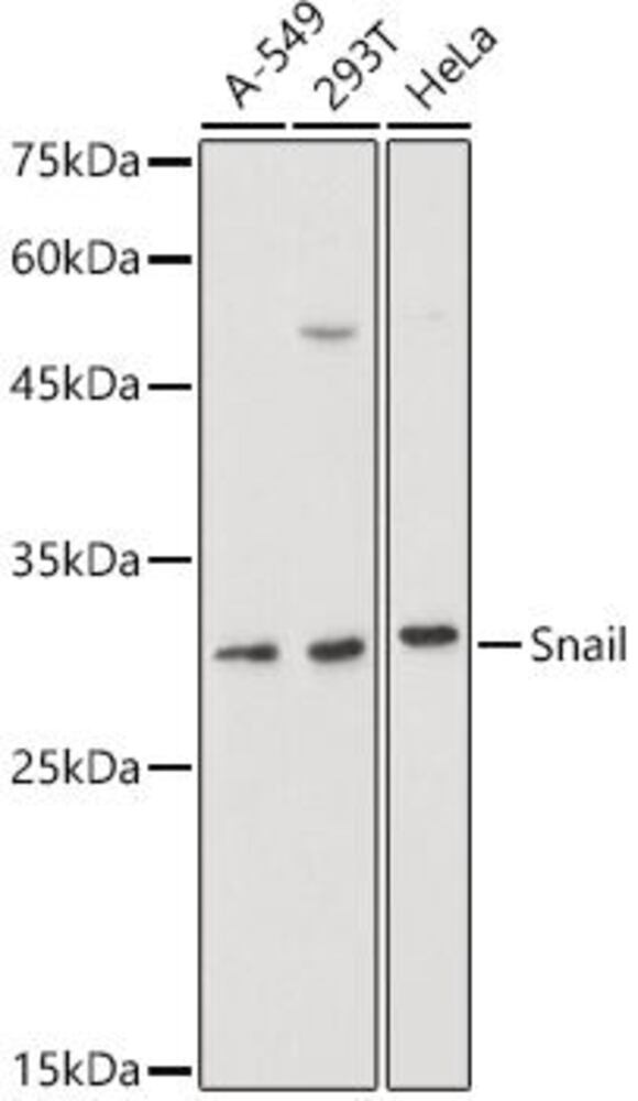 Anti-SNAIL Antibody, 100 µl - Luminix Health