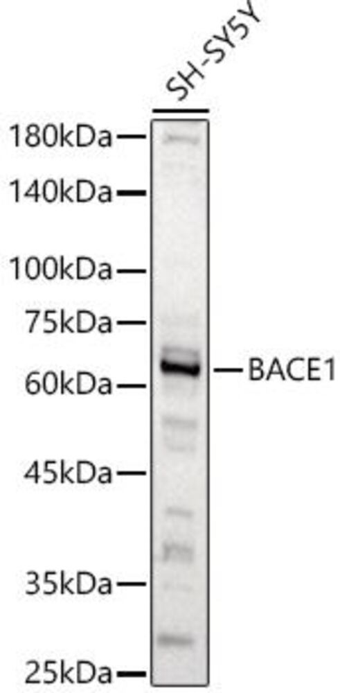 Anti-BACE1 Antibody, 100 µl - Luminix Health
