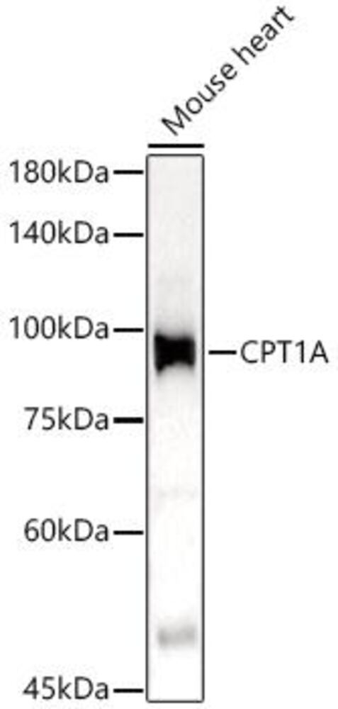 Anti-CPT1A Antibody, 100 µl - Luminix Health
