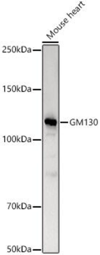 Anti-GM130 Antibody ab187514), 100 µl - Luminix Health