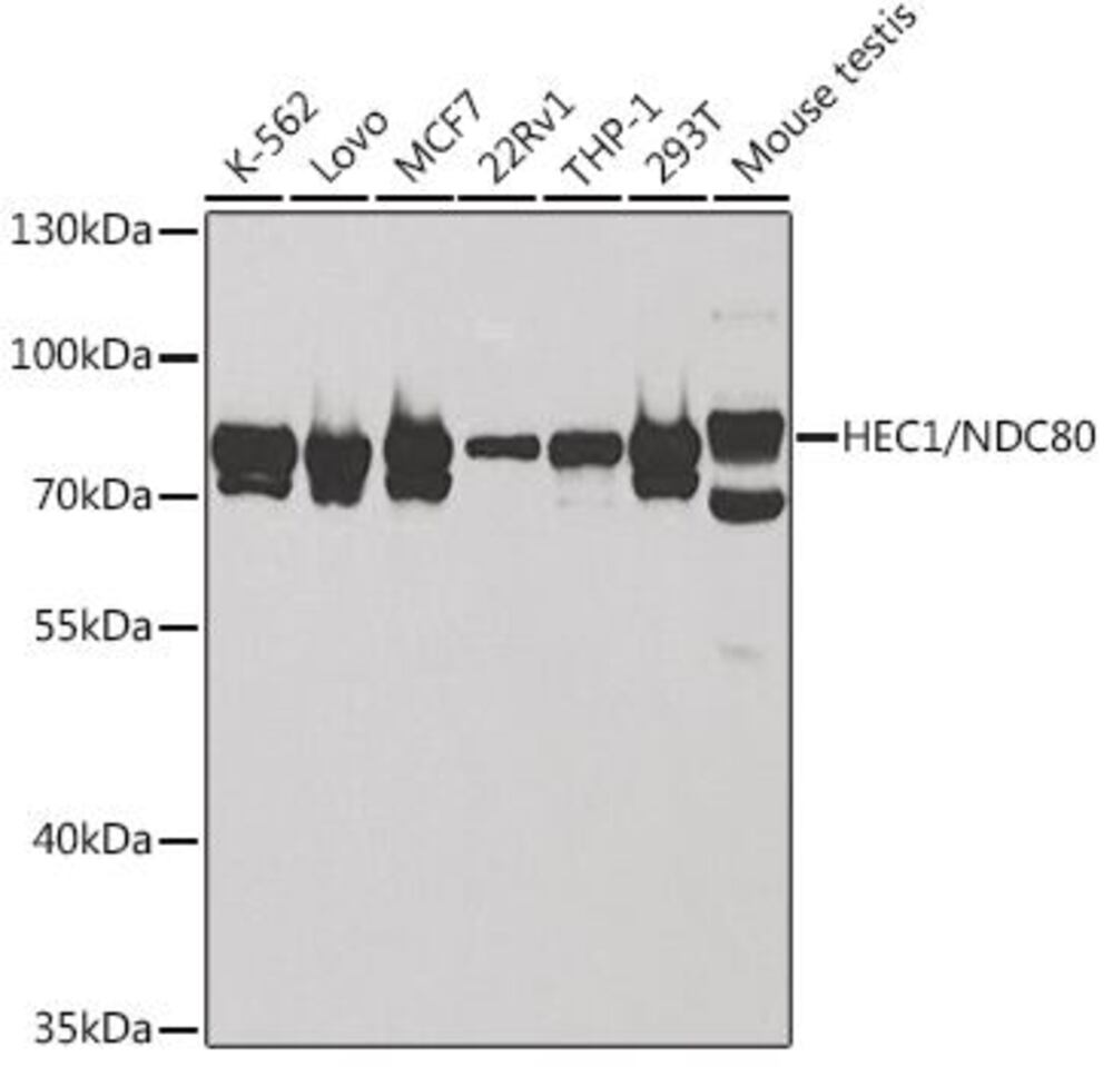 Anti-HEC1 / HEC Antibody, 100 µl - Luminix Health