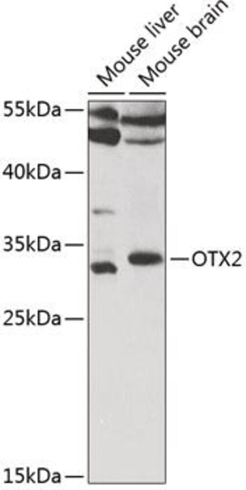 Anti-Otx2 Antibody, 100 µl - Luminix Health