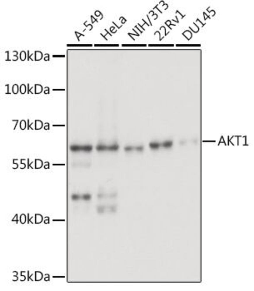 Anti-AKT1 Antibody, 100 µl - Luminix Health