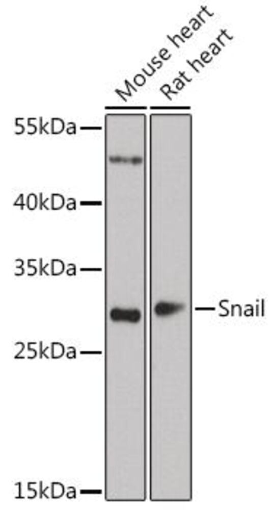 Anti-SNAIL Antibody ab180714), 100 µl - Luminix Health