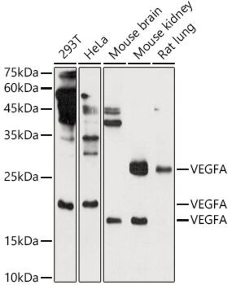 Anti-VEGFA Antibody, Density (D) 1 g/cm³, Storage temp. +4 °C - Luminix Health