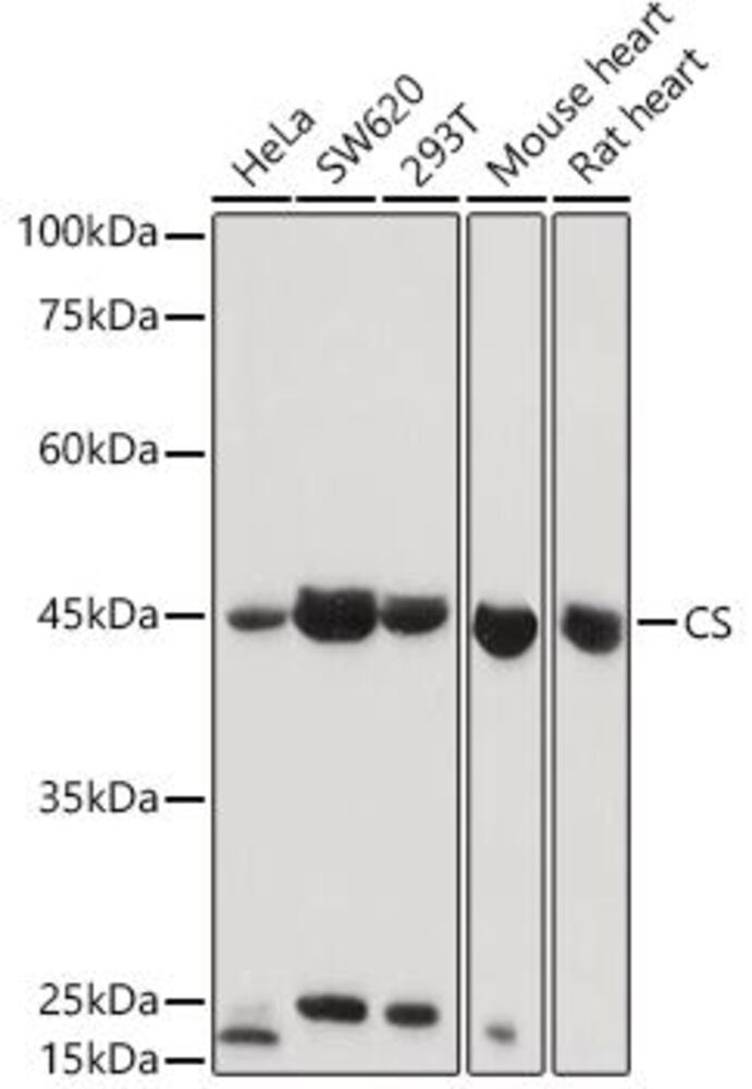 Anti-Citrate synthetase Antibody, 100 µl - Luminix Health