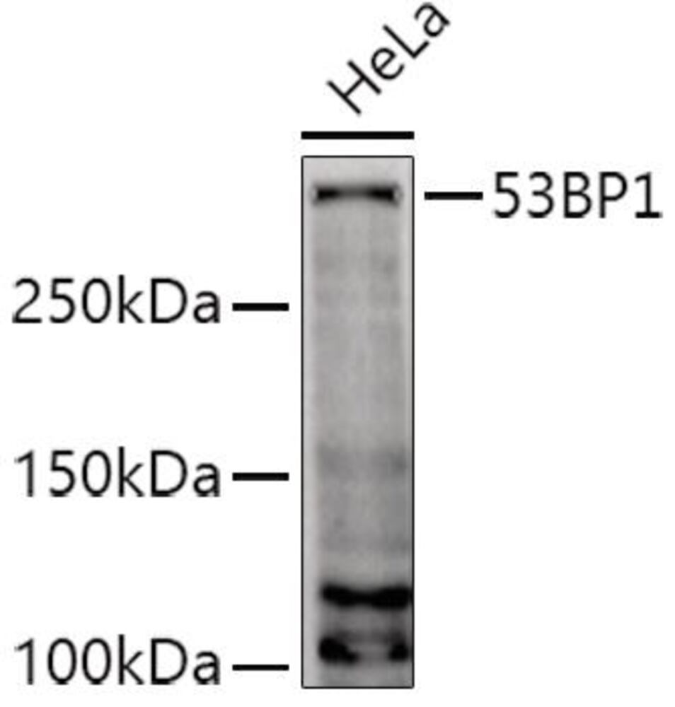 Anti-53BP1 Antibody, 100 µl - Luminix Health